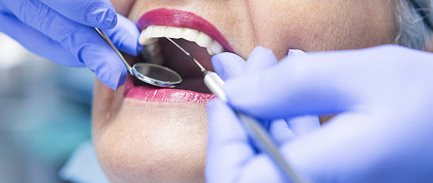 Best Dentist for Tooth Abscess  in Wray, CO